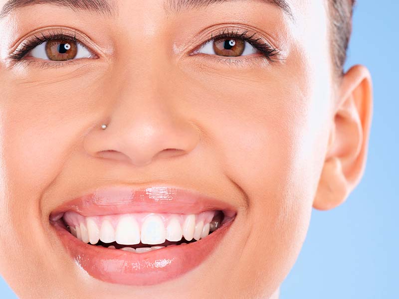 Woman showing a bright, healthy smile