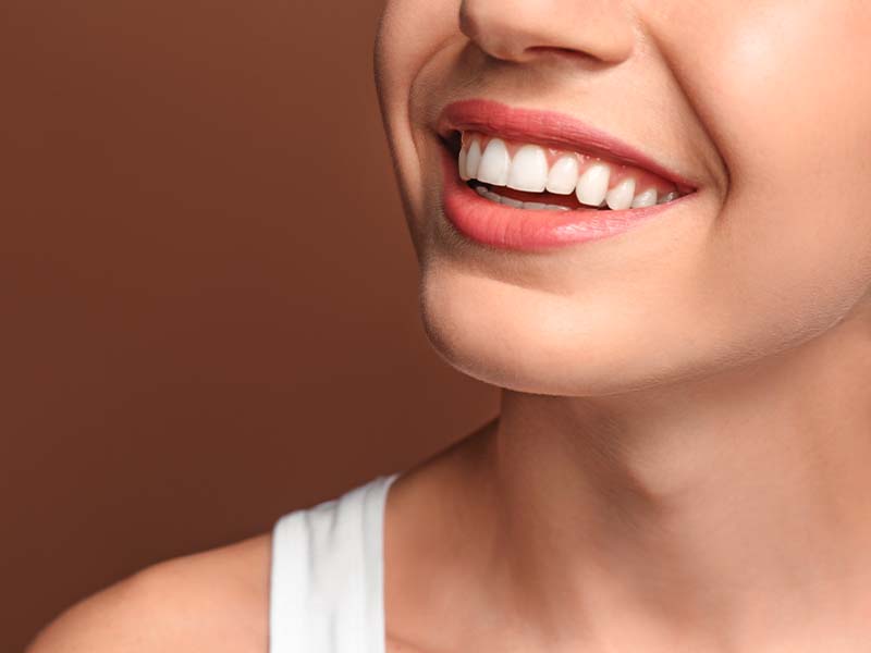 Close-up of a healthy white smile