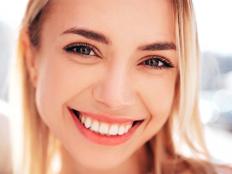 Woman showing a healthy smile