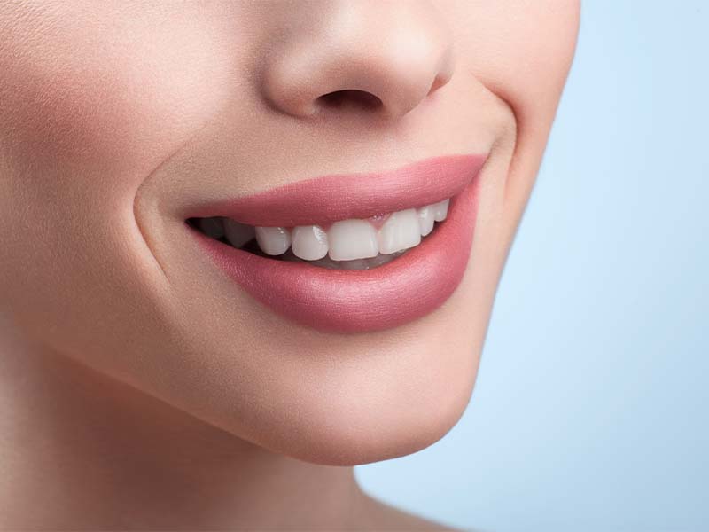 Close-up of straight, healthy teeth