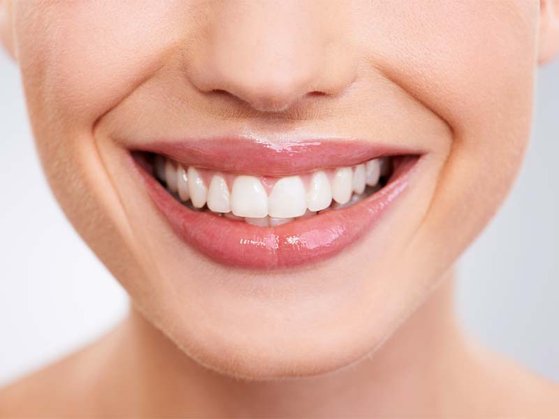 Close-up of clean, healthy teeth